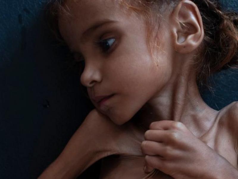 Η 7χρονη Αμάλ