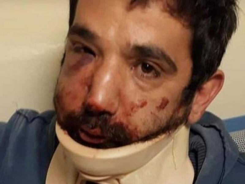 Ξυλοδαρμός διανομέα στη Θεσσαλονίκη