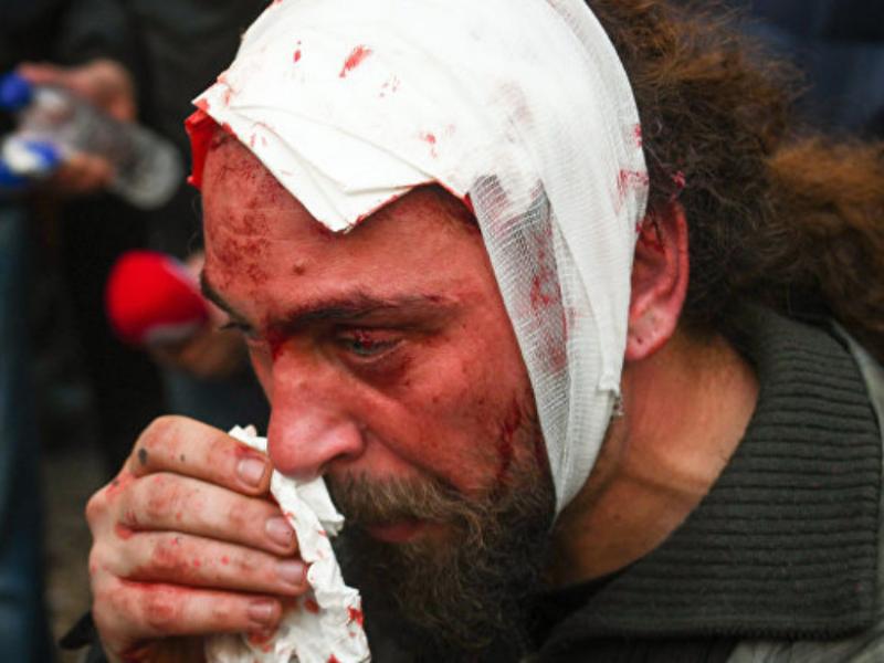 traymatismenos-fotoreporter