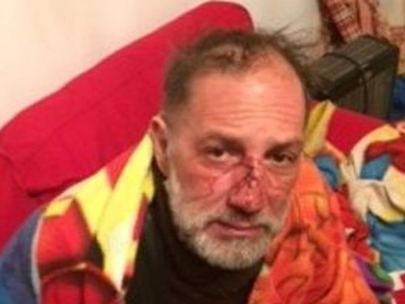 Ξυλοδαρμός φωτορεπόρτερ στα Εξάρχεια