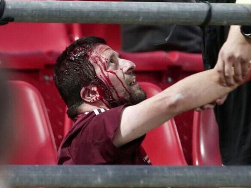 epithesi se poadous bayern