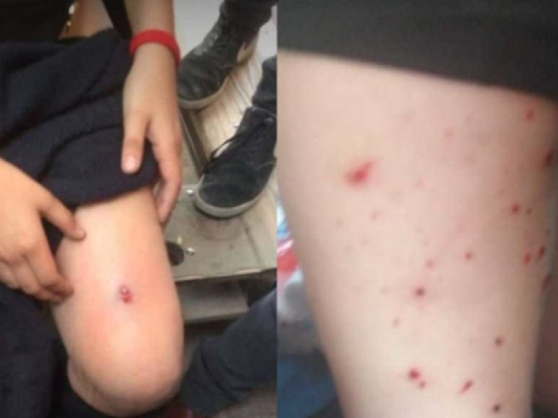 epithesi mathitries xili