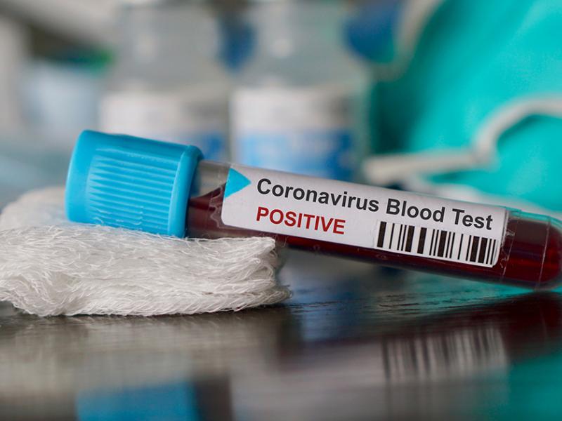 facebook-coronavirus-blood-test-covid-19-istock.jpg