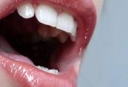 karkinos-sto-stoma.jpg