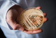 Candida auris