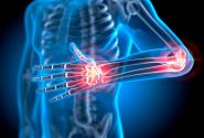 arthrwseis