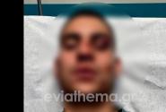 Ξυλοδαρμός στη Χαλκίδα
