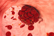 thrombos