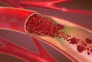thromvosi.jpg