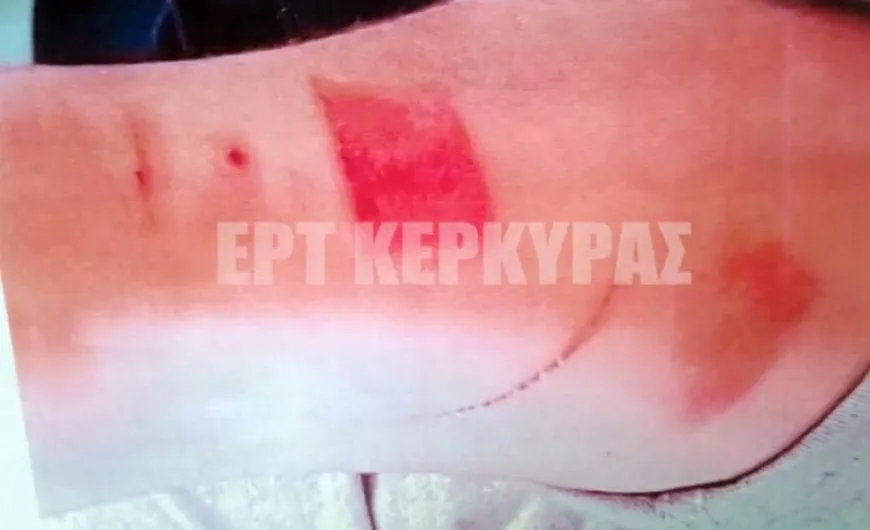 Καταγγελία σπουδαστή