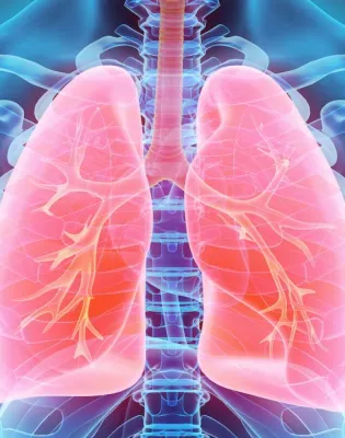 pneumonia