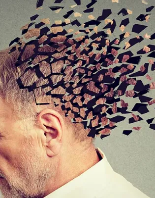 alzheimer
