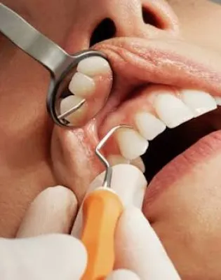 teeth