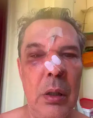 Απρόκλητη επίθεση στο Χαϊδάρι