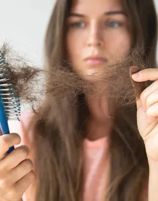 hairloss