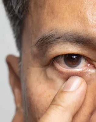 eyees