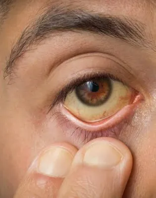 yellow eyes