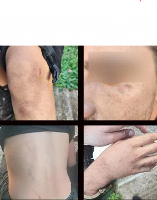 ασρτυν