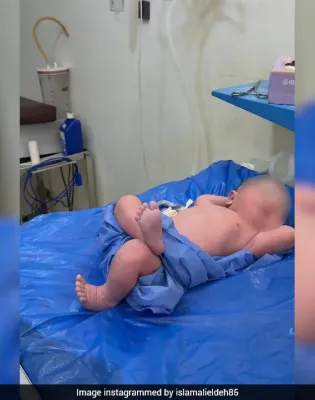 Μωρό viral στην Αίγυπτο