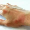 shutterstock_lupus