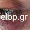 Ξυλοδαρμός κοπέλας από μπράβο