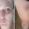 Ξυλοδαρμός τρανς