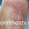 anemoni_paidi