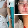 Σάλος για διεθνή αθλητή που σακάτεψε στο ξύλο την πρώην γυναίκα του