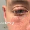 Ξυλοδαρμός μαθητών σε σινεμά