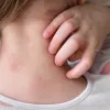 αυτ