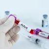 mpox