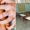 νορβηγική ψώρα