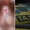 Επίθεση σε ταξί στον Πειραιά
