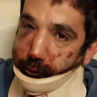 Ξυλοδαρμός διανομέα στη Θεσσαλονίκη