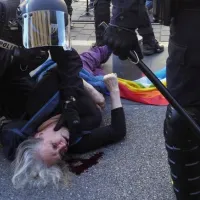 Τραυματισμός γυναίκας