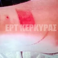 Καταγγελία σπουδαστή