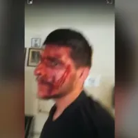 Ξυλοδαρμός