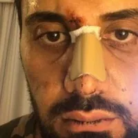 Ρατσιστική επίθεση