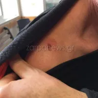 Πυροβολισμοί με αεροβόλο