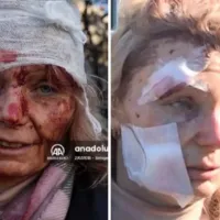 Τραυματισμένη δασκάλα στην Ουκρανία