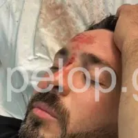 Απόπειρα δολοφονίας στην Πάτρα