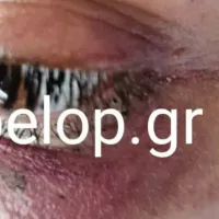 Ξυλοδαρμός κοπέλας από μπράβο