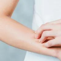 δέρμα