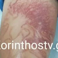 anemoni_paidi