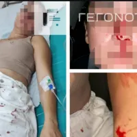 Σάλος για διεθνή αθλητή που σακάτεψε στο ξύλο την πρώην γυναίκα του