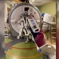 Νοσοκόμα παγιδεύτηκε σε μηχάνημα μαγνητικής τομογραφίας