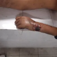 Άγριος Ξυλοδαρμός