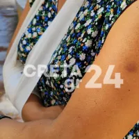 ξυλοδαρμος