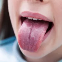 stoma
