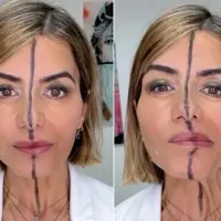 μποτοξ